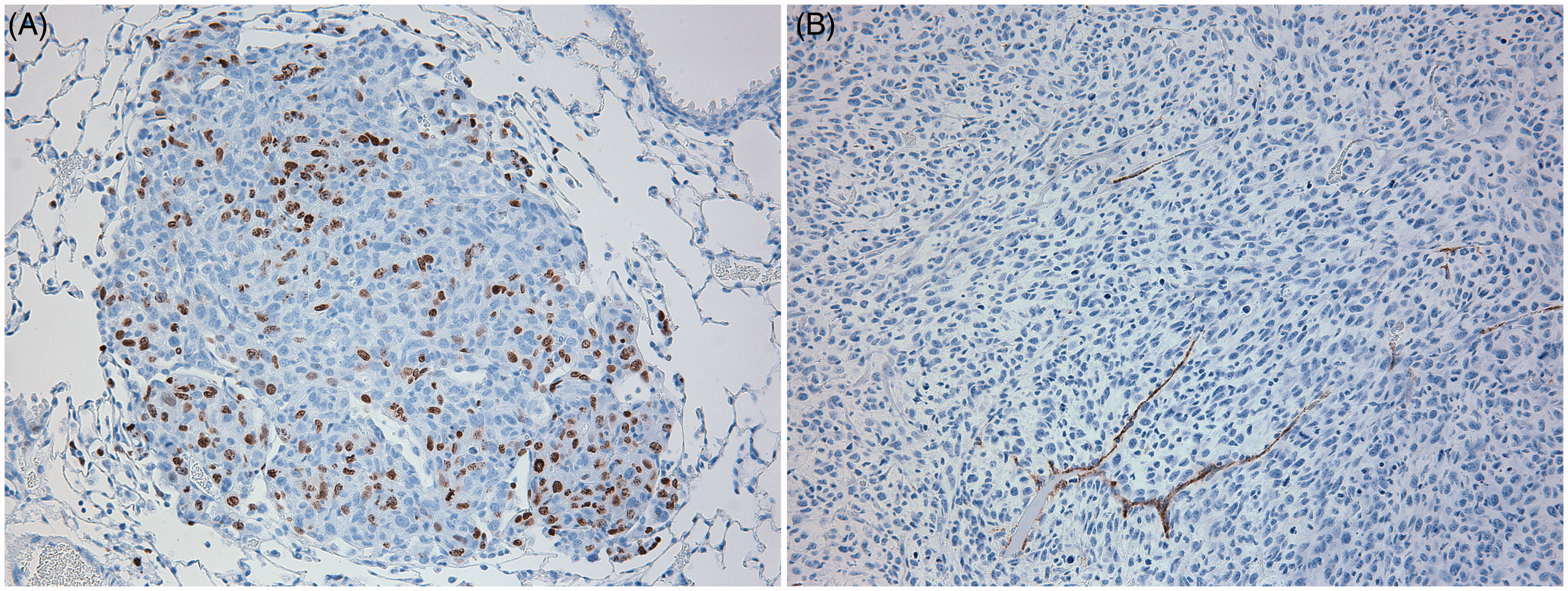Figure 5. Representative IHC images of SCC VII cells in lung, (a) IHC for BrdU, (b) IHC for vWF. 20X Magnification.