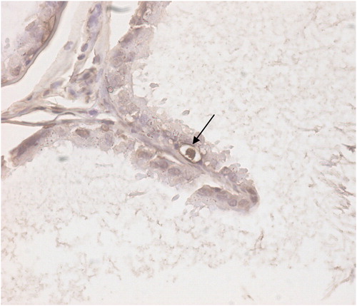 FIGURE 2 Apoptotic epididymal principal cell stained with TUNEL method. Black arrow shows apoptotic principal cell. Magnification (×400).