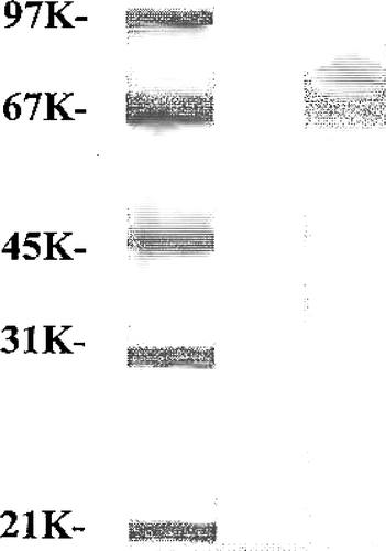 Figure 1 SDS-PAGE of purified hepatic ASB from normal mouse. From left to right, lane 1: standard proteins; lane 2: purified enzyme.