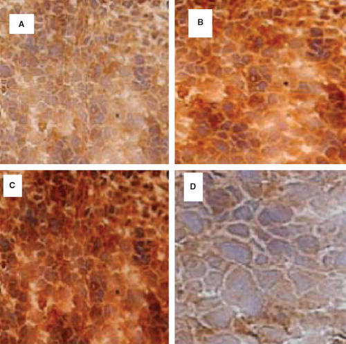 Figure 4. Expression of MIF in vivo. Expression of MIF protein was negative or weakly positive in healthy liver tissues (D). However, there was a significant increase in MIF expression in HCC specimens according to the time after injection in the first 48 h (A and B); and keeping the same level until 72 h (C).