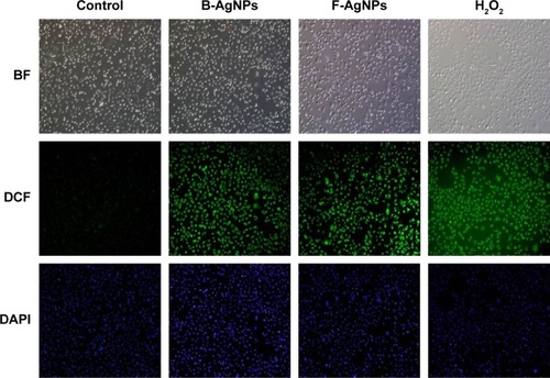 Figure 8 B-AgNPs and F-AgNPs induce ROS production in MDA-MB-231 cells.Notes: Fluorescence images of MDA-MB-231 cells treated with respective IC50 concentrations of B-AgNPs or F-AgNPs incubated for 24 hours. The image shows significant formation of H2O2 inside the MDA-MB-231 cells, whereas no fluorescence was observed in control cells.Abbreviations: B-AgNPs, bacterium-derived AgNPs; BF, bright field; DAPI, 4′,6-diamidino-2-phenylindole; DCF, 2′,7′-dichlorofluorescein; F-AgNPs, fungus-derived AgNPs; IC50, half-maximal inhibitory concentration; ROS, reactive oxygen species.