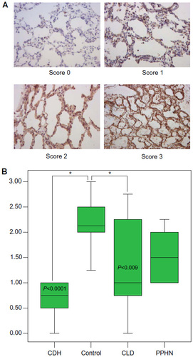 Figure 4 The NT-3 representative slide-staining (×400) scores (0–3) (A) and the corresponding intensity staining scores (B) at the parenchymal level. The control group NT-3 staining intensity had scores R 1.25–3.00, IQR 2.00–2.50, M 2.1, and the CDH group R 0.00–1.00, IQR 0.50–1.00, M 0.75. The CDH group score is significantly lower versus control, P<0.0001, CI 0.90–2.10. In this staining, CLD group score was significantly decreased relative to control. However, there was a wide range of scoring in this group: R 0.00–2.75, IQR 0.75–2.25, M 1.00, P<0.009, CI 0.20–1.50. The PPHN group score is not statistically decreased. *Shows statistical significance as indicated.