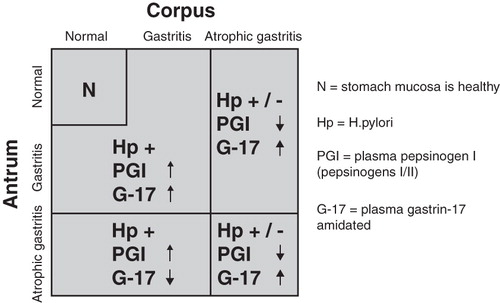Figure 2. Algorithm on how the plasma levels of stomach biomarkers are linked with nonatrophic Helicobacter pylori gastritis (previously so-called superficial gastritis) and with atrophic gastritis of various topographic phenotypes. Abbreviations: N = stomach mucosa is healthy; Hp = H. pylori; PGI = plasma pepsinogen I (pepsinogens I/II); G-17 = plasma gastrin-17 amidated.