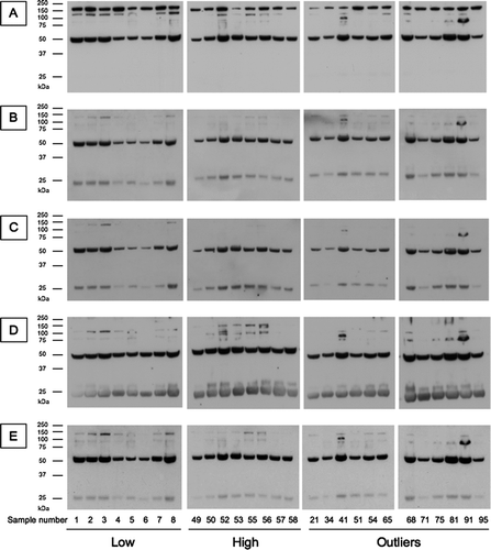 Figure 8  Western blot analysis of the outliers and controls (Low: lowest quartile, High: highest quartile of SP-D levels). Serum SP-D was purified by binding to maltose-agarose beads and analysed by western blot with (A) a polyclonal anti-SP-D antibody, (B) 1F4, (C) 246–4, (D) 246–2 or (E) 245–1 antibody.