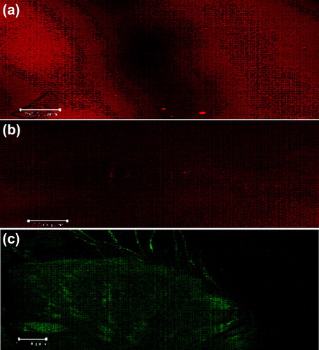 Figure 7. CLSM images of a cross-section of rat skin with different dye-loaded formulations. The formulations were applied for 4 h: (a) lipo-gel (b) nio-gel (c) emul-gel. The scale bar represents 200 μm.
