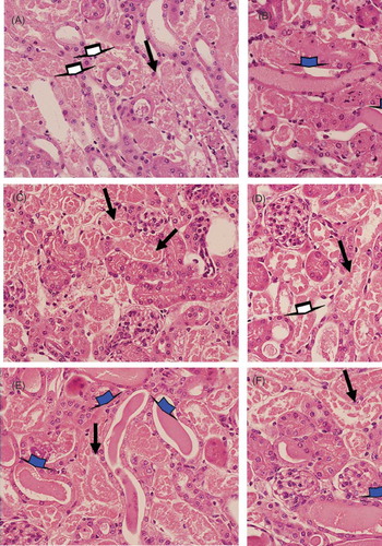 Figure 4. Histological analysis of kidney sections from HgCl2-injured mice treated (4B, D, and F) or not (4A, C, and E) with BMMC. Alterations in kidney morphology were observed 24 (4A and B), 48 (4C and D), and 72 h (4E and F) after HgCl2 injection. Magnifications 600×. Degeneration of tubular cells (black arrows), cellular debris (white arrows), and intratubular protein cylinder (blue arrows). Representative images of groups of mice euthanized at each time point (n = 5/group/time point).