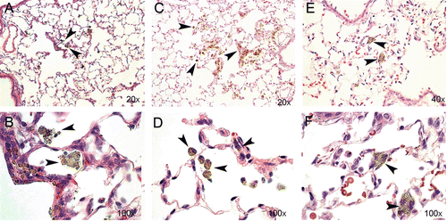 Figure 7.  Lung sections from rat tissue showing particle uptake at Days 2 (A and B), 30 (C and D), and 90 (E and F) post-nano-TiO2 exposure. Particle aggregates (arrows) can be found in alveolar macrophages at Days 2 and 30, and mainly in the interstitium at Day 90. The tissues were stained with hematoxylin–eosin.