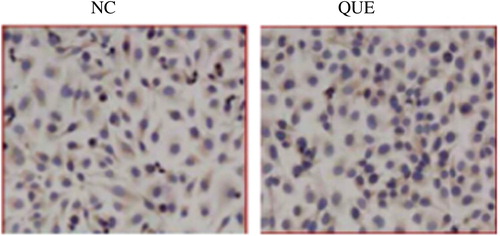 Figure 6. STAT3 immunocytochemistry in human bladder cancer EJ cell.