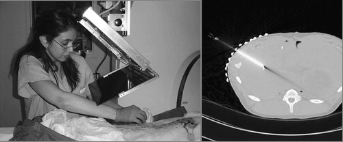 Figure 14. Needle insertion in the liver of a ventilated pig cadaver with straight gantry (left) and a confirmation CT image (right).