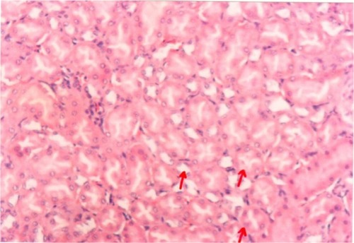 Figure 9 A photomicrograph of kidney of an Arabic gum-treated rat. The red arrows showing cortical tubules and peritubular capillaries with no pathogenic changes, ×200 magnification.