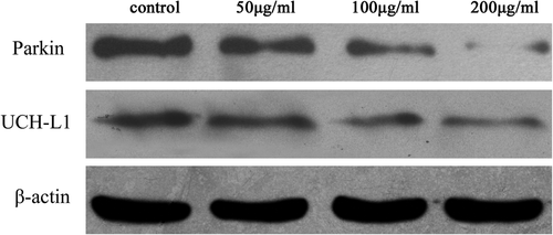 Figure 5. The result of western blotting, showing the expression of parkin and UCH-L1 after treatment with TiO2-NPs.