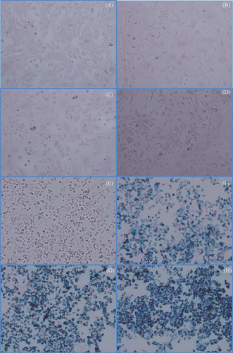 Figure 3. Prussian blue localisation of iron in cultures of HMECs or SK-BR-3 cells treated with Herceptin-directed nanoparticles as a function of time. Live HMEC cells (A–D) and SK-BR-3 cells (E–H) were incubated for either 0 (A, E), 1 (B, F) 2 (C, G) or 3 (D, H) h with Herceptin-directed iron oxide crystal-containing nanoparticles increase. Cells were then fixed and stained to localise iron using Prussian blue. No iron was retained by HMEC cells over the time course, but increasing amounts of iron could be visualised in association with Her-2 positive malignant mammary cancer cells in parallel.