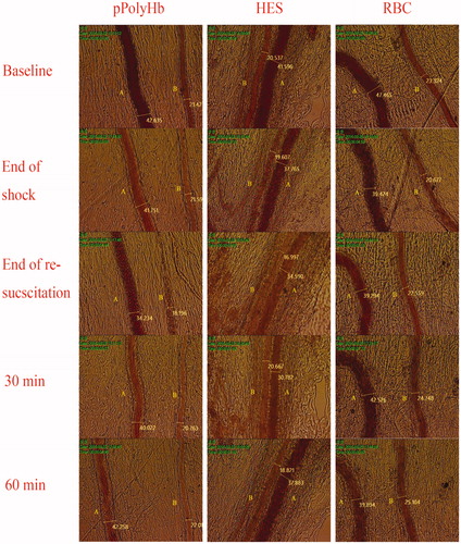 Figure 3. Microscopic observations of mesenteric microvascular from hemorrhagic shock model of rats. Microvascular digital images were recorded at baseline, the end of the shock, the end of resuscitation, 30 min and 60 min after resuscitation. The left column shows representative vessels from the pPolyHb group, the middle column from the HES group, and the right column from the RBC group. A: venule B: arteriole.