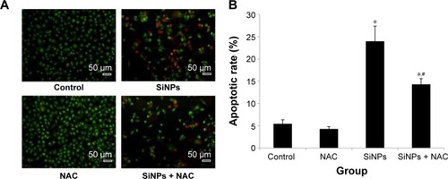 Figure 6 Apoptosis promoted by SiNPs, and the prevention by NAC.Notes: (A) AO/EB staining and flow cytometry using (B) Annexin V-FITC double-stain were used to detect the apoptosis of HUVECs after treatment with 50 μg/mL SiNPs for 24 hours plus NAC pretreatment (5 mM, 2 hours). Scale bar =50 μm, with the magnification of ×200. Data are expressed as mean ± SD from three independent experiments. *P<0.05 vs control; #P<0.05 for SiNPs vs SiNPs + NAC.Abbreviations: SiNPs, silica nanoparticles; NAC, N-acetylcysteine; AO, acridine orange; EB, ethidium bromide; HUVECs, human umbilical vein endothelial cells; SD, standard deviation.
