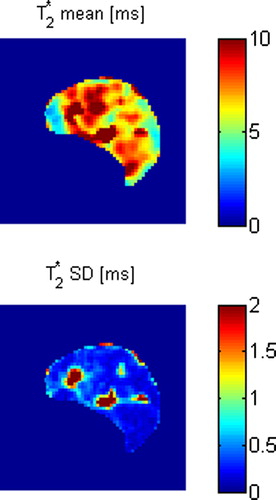 Figure 1. BOLD MRI parametric maps of T2* mean and SD for a control tumour.