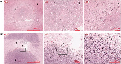 Figure 7. (A) Thermal lesion in healthy brain (rat sacrificed 48 h after HIFU); (B) Thermal lesion in brain tumour (rat sacrificed 4 h after HIFU). (1) centre, (2) peripheral, (3) healthy brain, (4) untreated tumour.