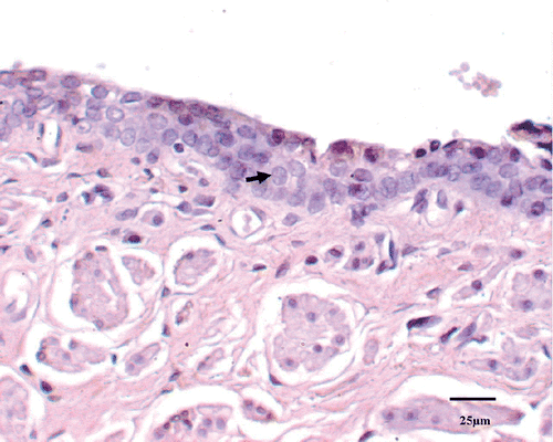 Figure 5. TUNEL staining on the samples demonstrated absence of apoptotic cells in the normal tissue. The intact cell is characterized by round to oval nuclei without TUNEL-stained chromatin (↑).