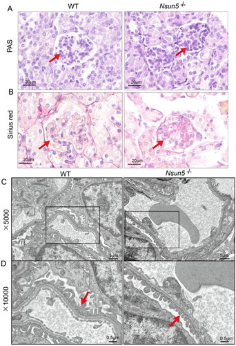 Figure 4. Kidney analysis of Nsun5-/- mice.(A) Representative images of kidney sections stained with periodic acid-Schiff (PAS) from Nsun5-/- and WT mice at PD 25 show significant glomerular glycogen deposition (red arrows). Scale bars: 20μm. (B) Representative images of kidney sections stained with Sirius red from Nsun5-/- and WT mice at PD 25 show significant glomerular collagen fiber hyperplasia (red arrows). Scale bars: 20μm. (C–D) Under electron microscopy, shortened podocyte foot processes (red arrows) can be observed in Nsun5-/- mice compared to WT mice at PD 25. The magnifications in (C) and (D) are 5000 × and 10,000×, respectively.