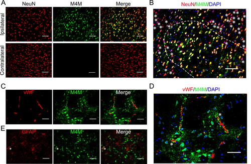 Figure 4. Immunofluorescent staining of TRPM4 using M4M in homozygous rats. Left MCAO was created for 3 h followed by 24-h reperfusion. (A) M4M (green) and neuronal marker, anti-NeuN (red) were used to co-stain neurons within the ipsilateral and contralateral hemispheres. (B) Co-localisation of anti-NeuN, M4M and DAPI (blue) within the ipsilateral hemisphere from A. Asterisks: M4M negative neurons. Majority of the neurons within the dotted line were positive for both NeuN and M4M. Scale bars for A–B: 100 µm. (C) Double staining of M4M (green) and endothelial marker vWF (red) on the ipsilateral hemisphere. (D) Co-localisation of vWF, M4M and DAPI (blue) within the ipsilateral hemisphere from C. Asterisks: partly colocalization of M4M and anti-vWF. (E) Double staining of M4M (green) and astrocyte marker GFAP (red) on the ipsilateral hemisphere. Asterisks: partly colocalization of M4M and GFAP. Scale bars for C–E: 50 µm.