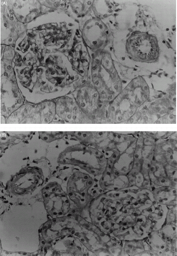Figure 6. Light microscopic observations of kidney sections of different treatment groups: (A) Renal cortex of a rat treated with vehicle (PAS, X500), (B) Interstitial fibrosis of stripped pattern and tubular atrophy in cortex of CsA treated rat (PAS, X125), (C) Arteriole with marked luminal narrowing and pronounced intimal thickening (Masson's trichome, X500), (D) Renal cortex of a rat treated with CsA (20 mg/kg) and TMZ (2.5 mg/kg) (PAS, X500).