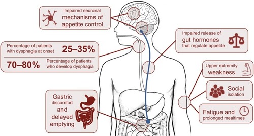 Figure 1 Mechanisms of impaired appetite control in amyotrophic lateral sclerosis (ALS).