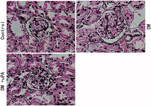 Figure 3. Pathologic change of rat renal tissues of the three groups (PASM × 400). (A) Control group. (B) diabetic (DM) group. (C) Diabetes treated with uPA (DM + uPA) group. AG, glomerular mean area. AM, mesangial area. VG, glomerular mean volume.