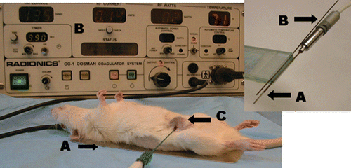 Figure 1. Rat tumor model. This figure demonstrates the experimental set up of RF ablation within the R3230 breast tumor model where (A) illustrates the grounding pad, (B) the RF generator, and (C) denotes the tumor with RF needle inserted. Inset: This illustrates the RF electrode A and thermocouple B inserted into an acrylic marker for insertion at specific radii to enable thermal mapping.