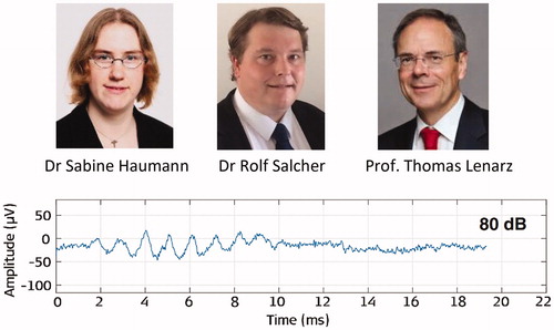 Figure 55. Clinicians from Hannover Medical School. Example of an intraoperative ECochG recording just after the electrode insertion process. Data is shown for 1,000Hz tone burst [Citation59]. Image courtesy of Dr Sabine Haumann, Hannover, Germany.