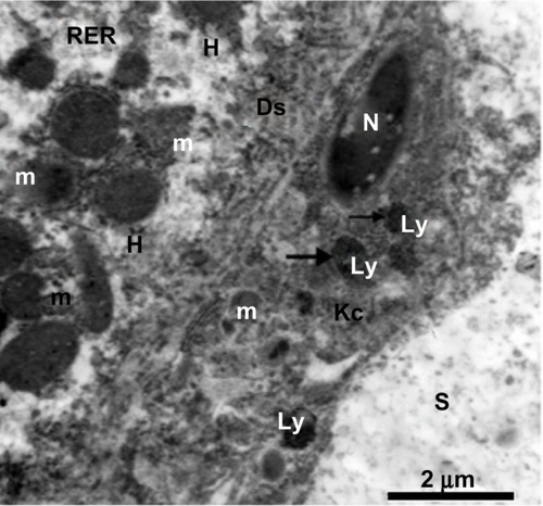 Figure 23 Transmission electron micrograph from the treated group. On the left, there is a cytoplasmic region of a degenerated hepatocyte consisting of numerous degenerated mitochondria, fragmented cisternae in the rough endoplasmic reticulum, and degenerated microvilli in Disse’s space. In the middle, there is a degenerated Kupffer cell containing a degenerated nucleus, degenerated mitochondria, and lysosomes filled with silver nanoparticles appearing as electron-dense material (arrows). Scale bar 2 μm.Abbreviations: Ds, Disse’s space; H, hepatocyte; Kc, Kupffer cell; Ly, lysosomes; m, mitochondria; N, nucleus; RER, rough endoplasmic reticulum; S, blood sinusoid.