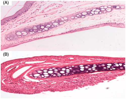 Figure 6. Light photomicrographs of (A) untreated rat epithelium (B) rat epithelium treated with in situ gelling of carvedilol-loaded transfersomal formula T14.
