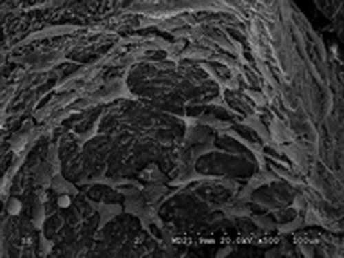 Figure 10. Compound for 5 d, transfected bone marrow mesenchymal stem cells fully spread and extend pseudopodia on the surface of nano-hydroxyapatite A material, calcium deposit can be seen around the cells.
