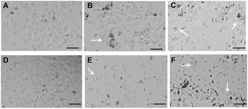 Figure 2 Morphological changes in HaCaT cells exposed to different concentrations of yttria-stabilized zirconia nanoparticles. (A) Control HaCaT cells for 24 hrs. (B) HaCaT cells exposed to 30 µg/mL for 24 hrs. (C) HaCaT cells exposed to 60 µg/mL for 24 hrs. (D) Control HaCaT cells for 48 hrs. (E) HaCaT cells exposed to 30 µg/mL for 48 hrs. (F) HaCaT cells exposed to 60 µg/mL for 48 hrs. Arrows indicate damaged HaCaT cells for 24 and 48  hrs. Scale bar is 50 µm.
