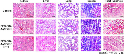 Figure 10 Histological analysis of the nontumorous major organs. After the efficacy study was terminated, the mice were sacrificed and the major organs (kidney, liver, lung, spleen, and heart) were harvested. The paraffin-embedded tissue sections stained with hematoxylin and eosin (H&E) showed no obvious signs of toxicity in organs of all the mice.