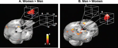 Figure 4.  Sex-related differences identified in the amygdala showing a hemispheric asymmetry in memory-related activity. (A) Activity in the left amygdala while viewing emotionally arousing images was more significantly related to subsequent memory for the images in women than in men, and (B) the opposite pattern was observed in the right amygdala, i.e., greater activity in men than in women. Reproduced from Cahill et al. (2004), with permission.