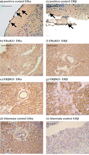 Figure 4. Rabbit polyclonal antibody to mouse was used for detection of ERα in a) positive control, murine brain, b) ERαKO mouse myocardium and c) ERβKO mouse myocardium, (d) littermate control mouse myocardium; and for detection of ERβ in e) positive control, murine brain, f) ERαKO mouse myocardium and g) ERβKO mouse myocardium, (h) littermate control, mouse myocardium. The marker represents 100 μm. Arrows indicate positive cells.
