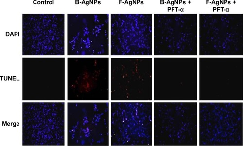Figure 14 PFT-α inhibits B-AgNPs- and F-AgNPs-induced apoptosis in a p53-dependent manner.Notes: Cells were pretreated with PFT-α (10 μM) for 1 hour and then incubated with respective IC50 concentrations of B-AgNPs or F-AgNPs for 24 hours. Apoptosis was measured using the TUNEL assay.Abbreviations: B-AgNPs, bacterium-derived AgNPs; DAPI, 4′,6-diamidino-2-phenylindole; F-AgNPs, fungus-derived AgNPs; IC50, half-maximal inhibitory concentration; PFT- α, pifithrin-alpha; TUNEL, terminal deoxynucleotidyl transferase dUTP nick end labeling.