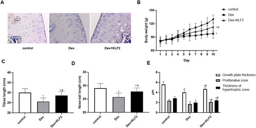 Figure 6. Overexpression of KLF2 alleviates growth retardation in rats. SD rats were injected with Dex intraperitoneally and KLF2 overexpression vector in the joint, and were divided into three groups: control, Dex, Dex + KLF2. (A) Immunohistochemistry was used to analyse the expression of KLF2 in rat tibiae growth plate. (B-D) Quantification of the rat body weight, length of tibiae and nose-tail. (E) Quantification of the thickness of growth plate, proliferative zone and hypertrophic zone. “*” means compared with control group p < 0.05, and “#” means compared with Dex group p < 0.05.