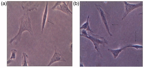 Figure 4. Myofibroblast-like change of mesangial cells after co-culture with 2 ng/ml of TGF-β1. One myofibroblast-transformed cell after 12 h induction of TGF-β1 (a) and several myofibroblast-transformed cells after 24 h induction of TGF-β1 (b) as indicated by using arrows.