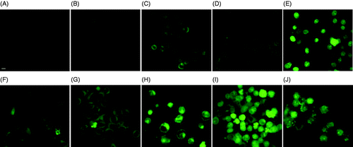 Figure 5. DOX fluorescence in Dx5 cells treated by only DOX (A and F), DOX + 1 h 43°C incubation (B and G), DOX + 30 min 50°C incubation (C and B), DOX + 3 min laser/5 µM ICG (D and I), and DOX + 3 min laser/10 µM ICG incubation (E and J). Images were taken either 1 h after (A, B, C, D and E), or 24 h after the treatment (F, G, H, I and J). The scale bar represents 8 µm.