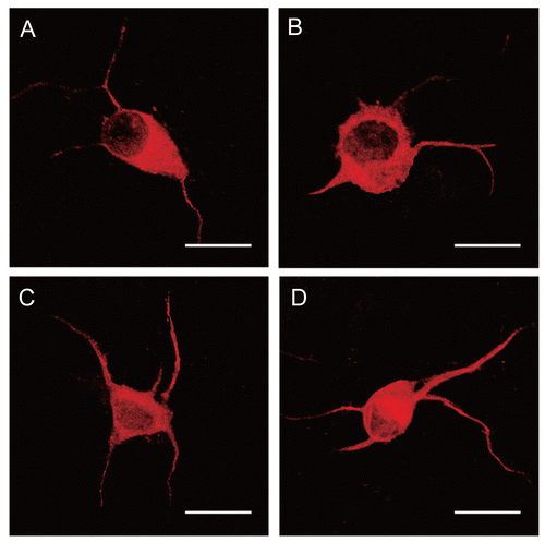 Figure 3.  Dissociated DRG neuronal cultures at 2 days of culture were then treated with NGF and/or NE for an additional 4 days and then immunostained with anti-sera to MAP2. Panel A: Normal control. Panel B: Exposure of NE (10−4 mol/L). Panel C: Exposure of NGF (10 ng/mL). Panel D: Exposure of NGF (10 ng/mL) and NE (10−4 mol/L). The number and length of neurites increased in NGF-treated DRG neurons. Scale bar = 20 μm.