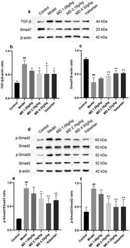 Figure 6. Effect of Mudan granules on the expression of TGF-β/Smad2/3 pathway proteins in kidney tissues of diabetic rats. a: TGF-β and Smad7 protein expression in kidney tissues of rats. b: TGF-β/β-actin ratio. c: Smad7/β-actin ratio. d: Smad2, Smad3 and phosphorylation protein expression in kidney tissues of rats. e: Smad2/p-Smad2 ratio. f: Smad3/p-Smad3 ratio. All data were expressed as mean ± SD, n = 3. Compared with the control group, #P < 0.05, ##P < 0.01. Compared with the diabetic model group, *P < 0.05, **P < 0.01.
