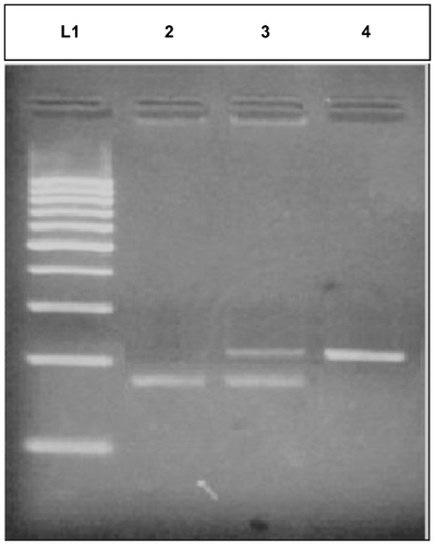 Figure 2 Representative gel picture of PTPN22 C<T polymorphism.