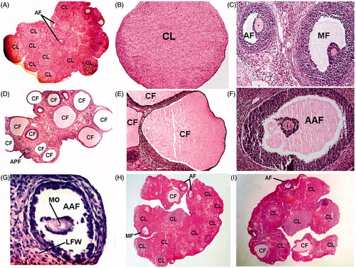 Figure 1. Ovarian sections of control and experimental groups. (A) Lower magnification (40×) of ovarian section showing normal folliculogenesis as well as several CL from the control rat. (B) Higher magnification (400×) of control ovary showing fresh CL. (C) Higher magnification (400×) of two intact antral follicles with a clear oocyte surrounded by cumulus cells and several layers of granulosa cells (×400). (D) Section of ovary from PCO rats showing multiple fluid-filled sub-capsular cysts (40×). (E) Higher magnification (400×) of a fluid-filled large cystic follicle of PCO rats with a degenerated thin layer of granulosa cells and hyperplasia of theca cells (×400). (F) Higher magnification (400×) of one antral degenerating atretic follicle showing detached floating oocyte. (G) An antral atretic follicle with a malformed oocyte and luteinized theca cells (400×). (H) Section of the ovary from the PCO + CVL group showing normal developing follicles and several CL (×40). (I) Section of the ovary from the PCO + ANP group showing normal developing follicles and several CL (×40). AF, antral follicle; AAF, atretic antral follicle; CF, cystic follicle; CL, corpora lutea; LGW, luteinized follicular wall; MF, mature follicle; MO, malformed oocyte.