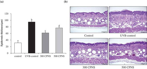 Figure 7. Effect of CPNS supplementation on UVB-induced epidermis thickness. The dorsal skin surface of hairless mice was exposed to UVB three times a week for 12 weeks, and the mice were supplemented with saline or CPNS. At the end of the experiment, histological analysis was performed to evaluate (a) epidermis thickness. (b) Histological sections were stained with hematoxylin and eosin.
