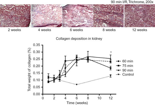 Figure 5. Compared to the control kidneys, all three ischemic groups demonstrated increases in collagen deposition during the 4th week, and continued to rise sharply until 6 weeks. There was, no significant difference between the groups, except at the 12 week time point, in which the 90-min ischemic kidneys appeared to have more collagen deposition than the 75-min kidneys (*p < 0.05).