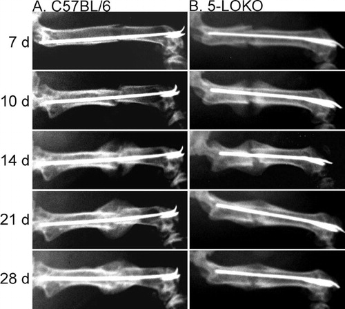 Figure 1. Radiographic examination of fracture healing in 5-LOKO mice and control C57BL/6 mice. Shown are serial dorsal-ventral radiographs made from a C57BL/6 mouse (column A) and a 5-LOKO mouse (column B) of identical age and genetic background at 7, 10, 14, 21, and 28 days after fracture, as indicated.