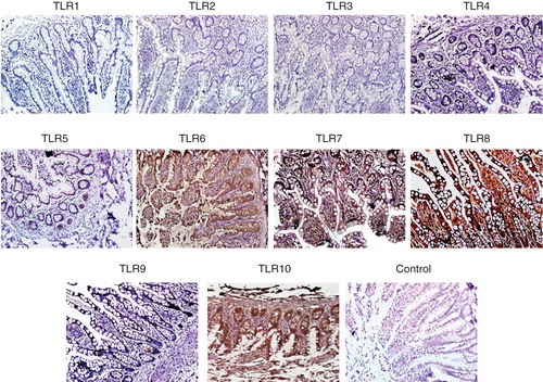 Figure 5. Immunohistochemical detection of TLR on paraffin sections of human small intestine. Small intestine biopsies from healthy individuals were stained for various Toll-like receptors (TLRs). No expression of TLR-1, -2, -3, -4 and -9 were found. However, the following TLRs were found to be expressed in the SI sections. TLR-5: weak positive staining is observed along the entire epithelial layer. TLR-6: epithelial layer showed moderate staining while intense reaction observed in the lamina propria cells and granules of paneth cells. TLR-7: both villus and crypt epithelial cells showed granular-positive reaction. TLR-8: diffuse positive staining of moderate intensity is observed along the whole epithelial layer. Many cells in the lamina propria also showed positive reaction. In two samples, intense positive reaction for TLR-8 is observed at the luminal side of epithelial layer; in these samples, few lamina propria cells showed positive reaction. TLR-10: intense positive reaction is observed in epithelial cells along the entire crypt–villus axis. Intense brown reaction was observed in the granules of paneth cells and also many lamina propria cells are intensely stained. Magnification 40×.