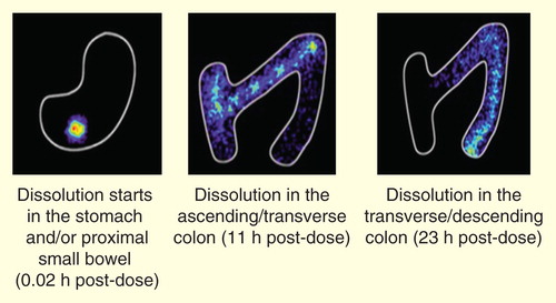 Figure 2. Depiction of the absorption of MeltDose® formulation of tacrolimus throughout the gastrointestinal tract across 24 h.