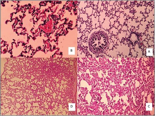 Figure 4. Lung tissue morphology in the rat in acute and sub-chronic period; (A): control group (×100), (B): One-week exposure (×400) shows alveolar walls are damaged. Contrary to the normal tissue, Type II pneumocystis increased and covers about 30% of the alveolar surface. Some alveoli are full of discharge and are seen in some types of bleeding, (C): 6h exposure (×100) shows Type II pneumocystis covers about 80% of the alveolar surface, resulting in a thickening of the alveoli. Spreading within the alveoli, severe vessel dilatation, and alveolar wall necrosis are also observed. Alveolar injury is more of an interstitial type that is in the vicinity of airways with greater intensity than near the pleural area, and (D): 4 weeks exposure (×40) shows a large number of interstitial (70% lung tissue) focuses on increasing intra-alveolar secretions. Pneumocystis Type II covers approximately 30% of the alveolar levels. Small haemorrhage can also be seen.