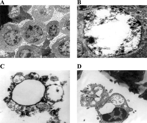 FIG. 4 Transmission electron microscopy (TEM) photographs showing apoptosis in avian lymphocytes induced by deltamethrin. (A) Control lymphocytes (X11,000). (B) Margination of chromatin (X15,000). (C) Formation of apototic bodies (X11,000). (D) Phagocytosis of apoptotic bodies (X11,000).